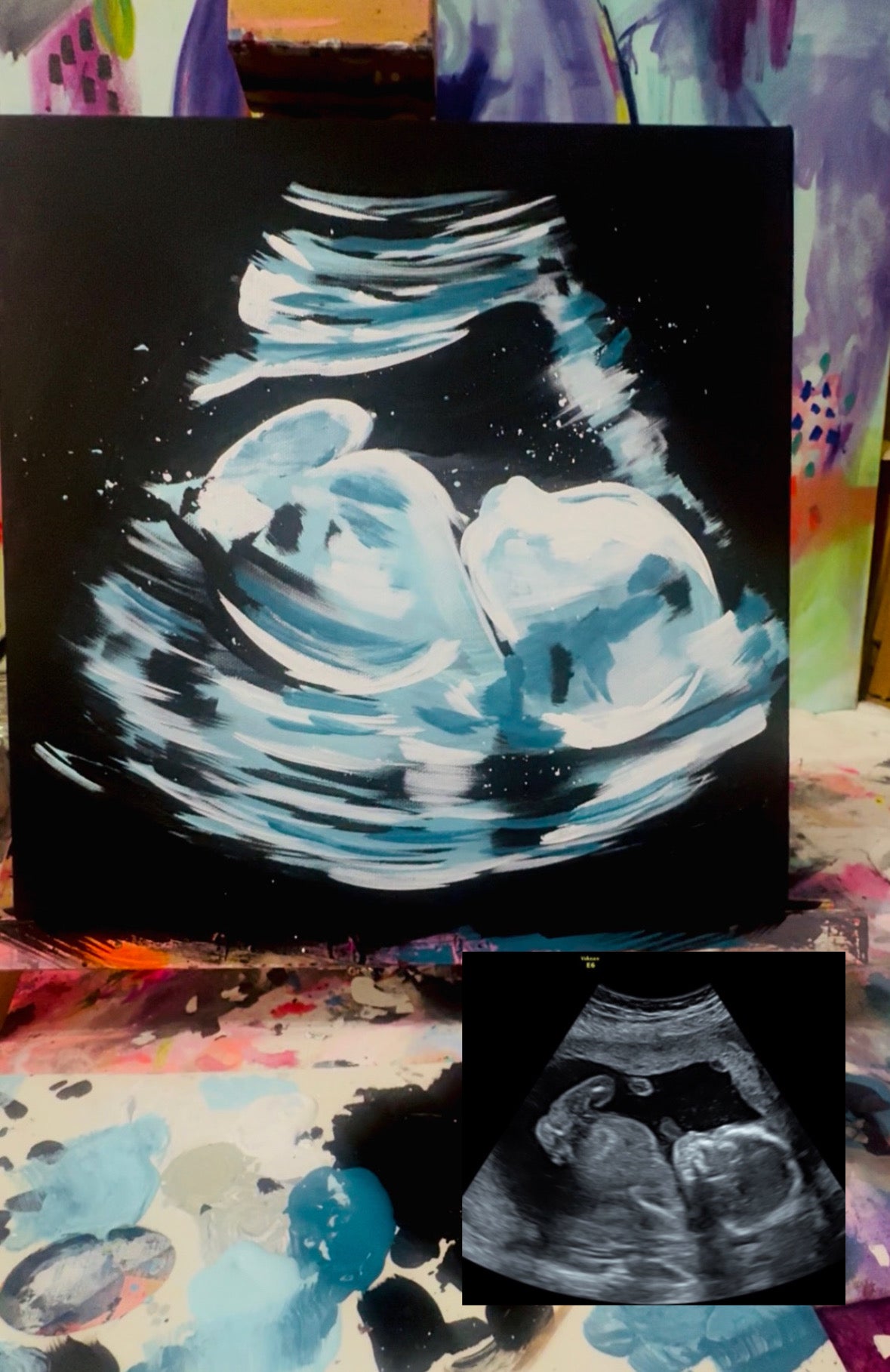Custom Abstract Ultrasound Painting - Commissioned Artwork