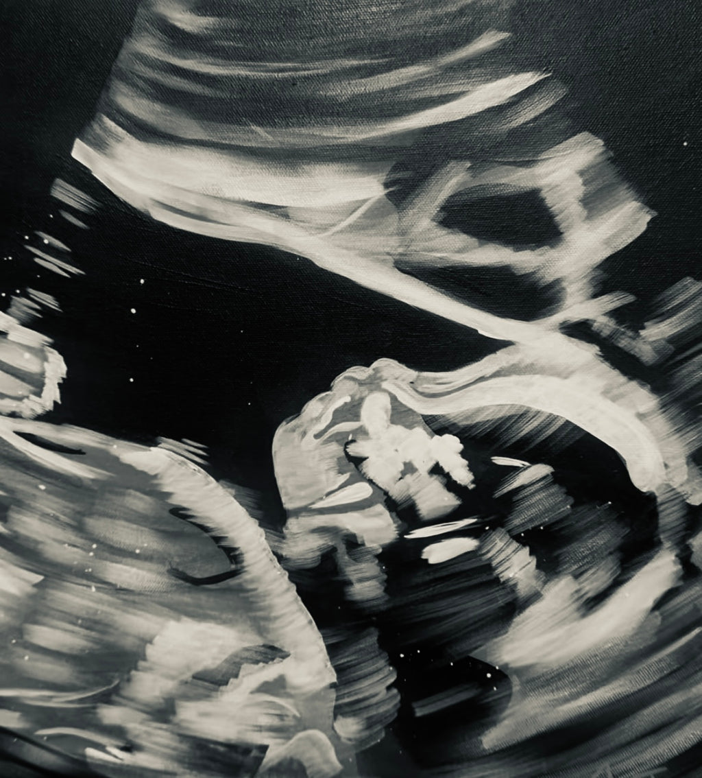 Custom Abstract Ultrasound Painting - Commissioned Artwork