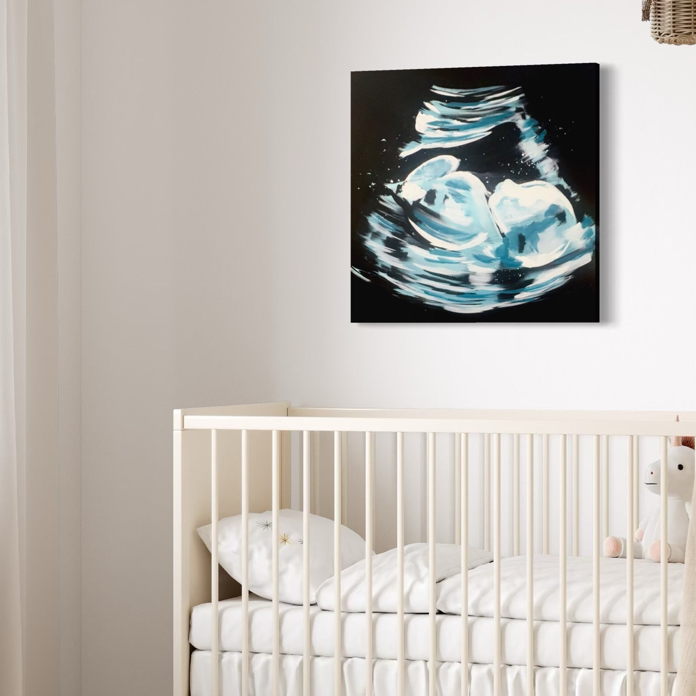 Custom Abstract Ultrasound Painting - Commissioned Artwork